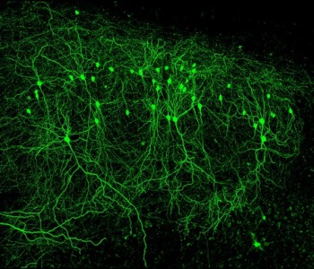 Памятью управляет РНК нейронов